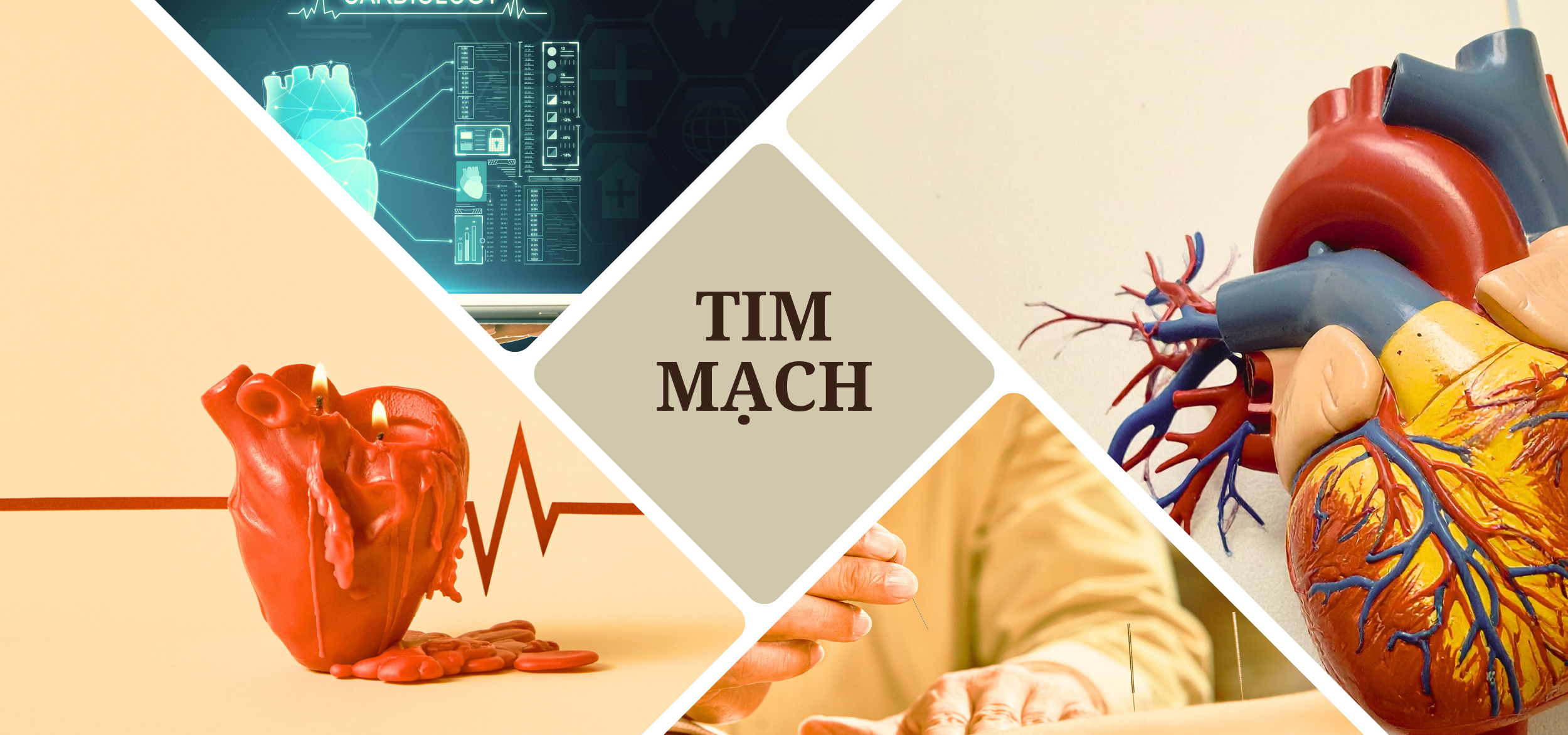 Tim mạch